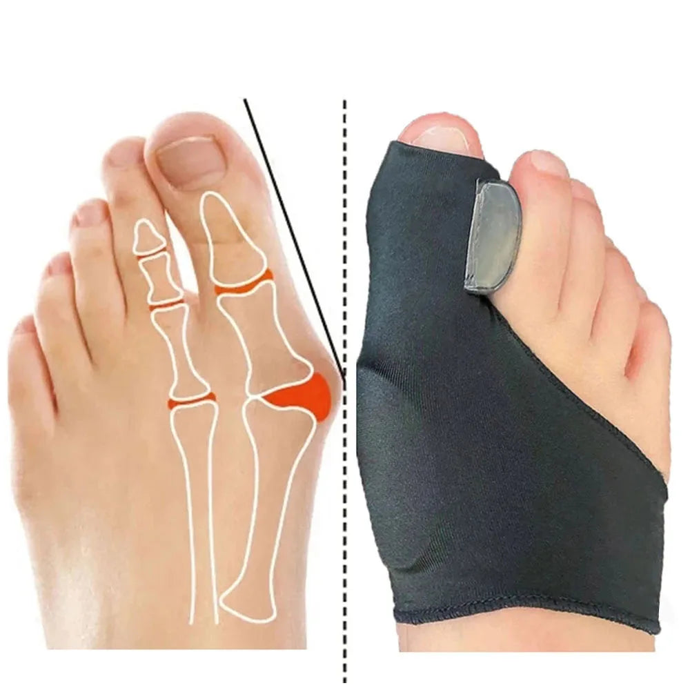 Bunion Corrector