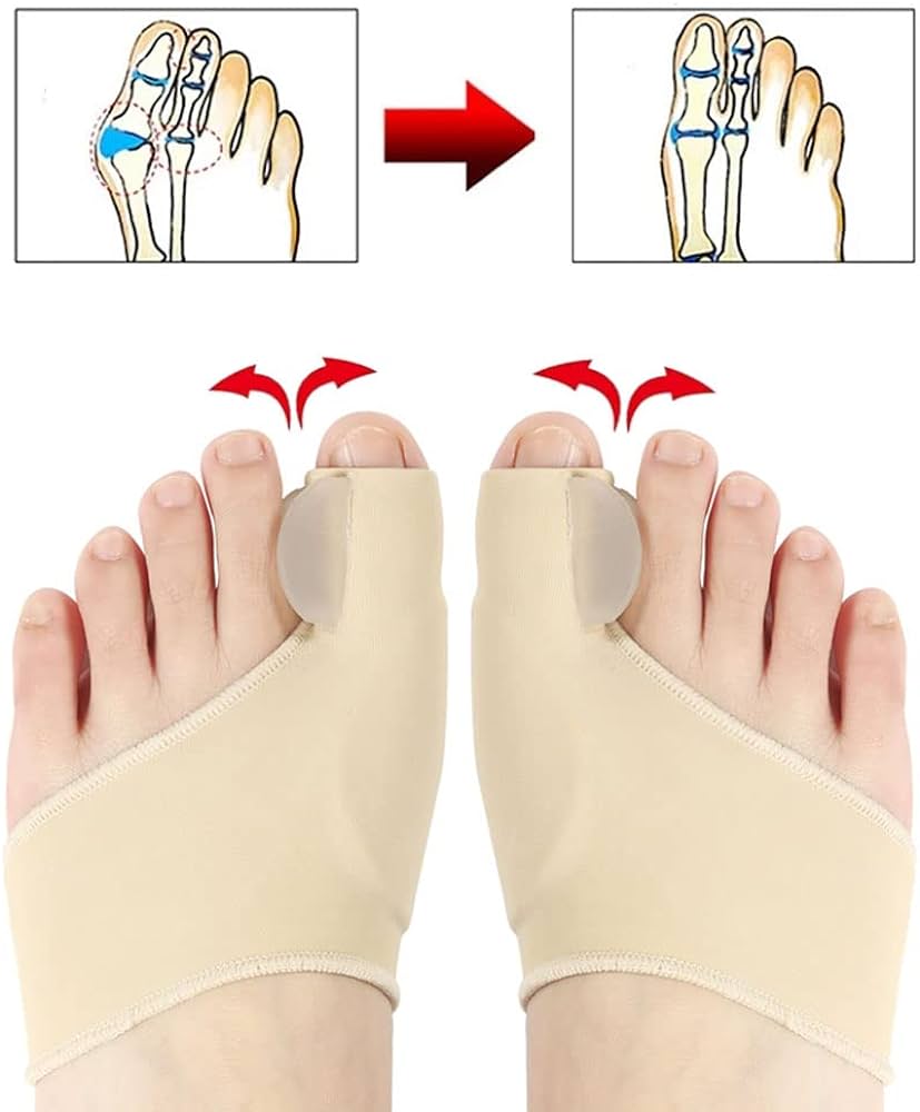 Bunion Corrector