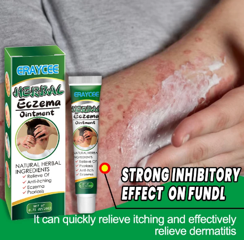 Eczema Treatment