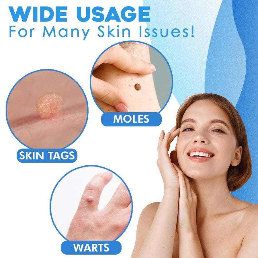 Auto Skin Tag Removal Kit