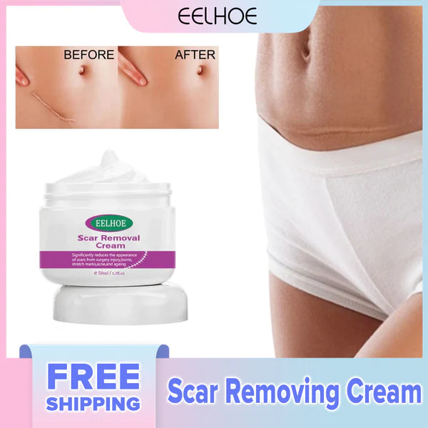 Scar Removal Cream
