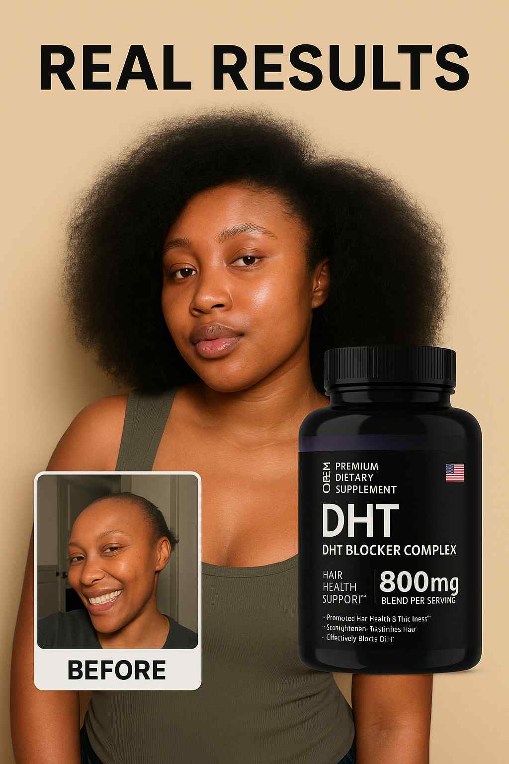 Hair Loss Vitamins